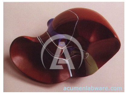 Acumen Labware