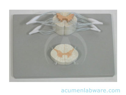 Acumen Labware